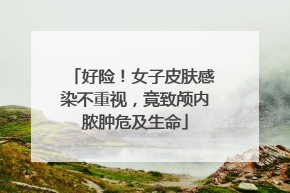 好险！女子皮肤感染不重视，竟致颅内脓肿危及生命